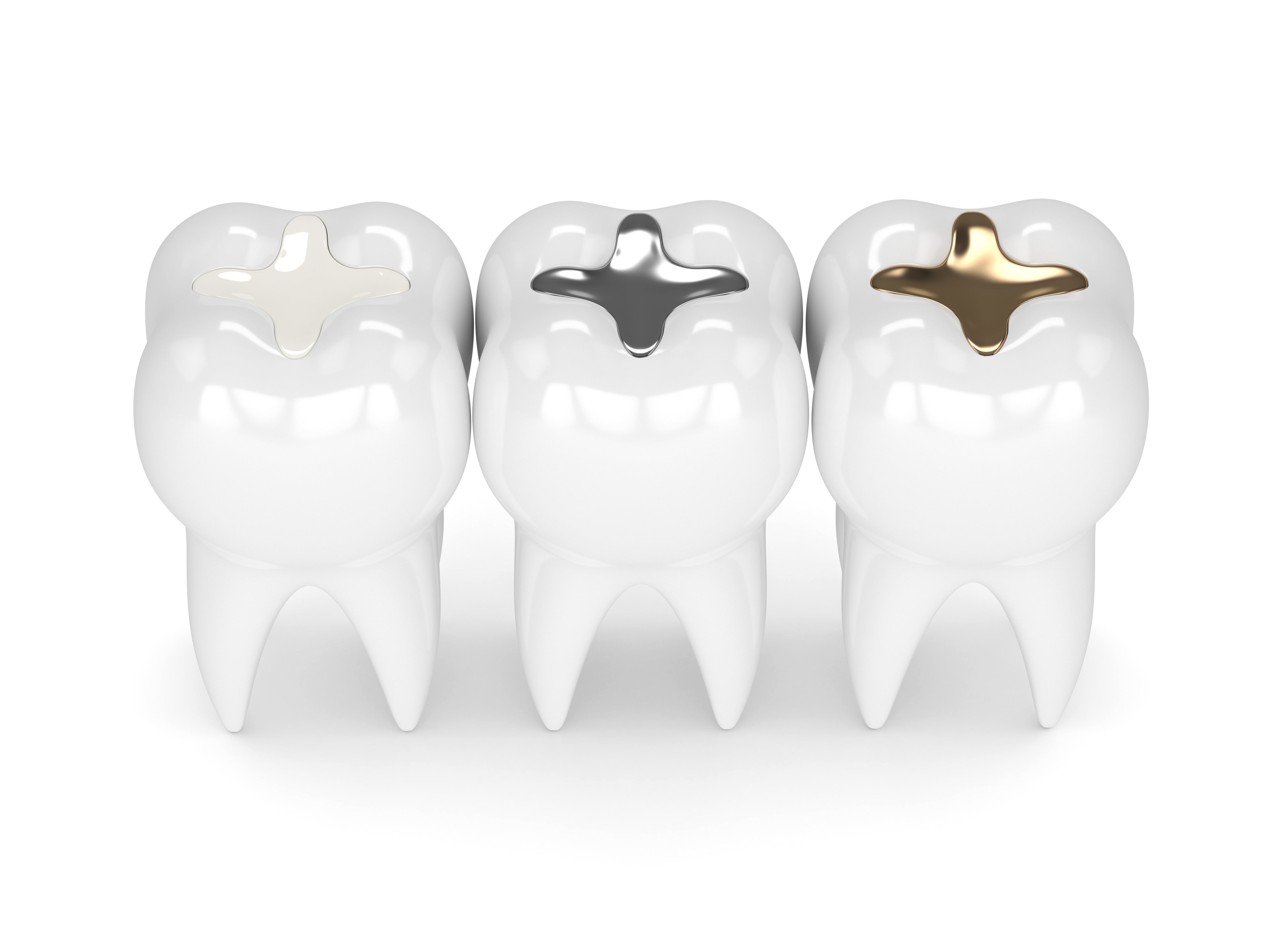 Are Amalgam (Silver) Fillings Safe? Fallbrook Dental Care